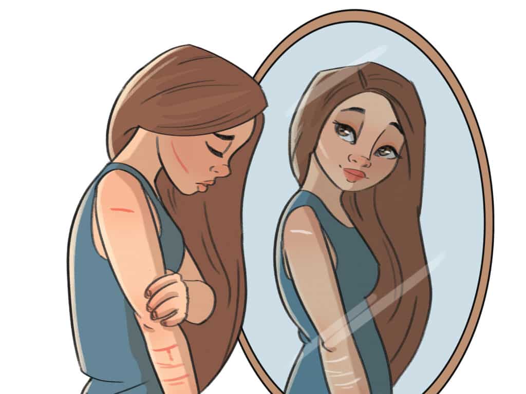 illustration of sad scarred woman in mirror but happy reflection